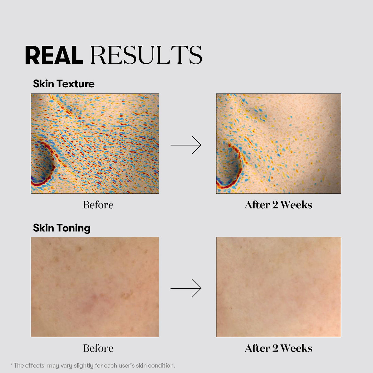 VT Cosmetics TX-Toning Cream 50ml - official product image 6