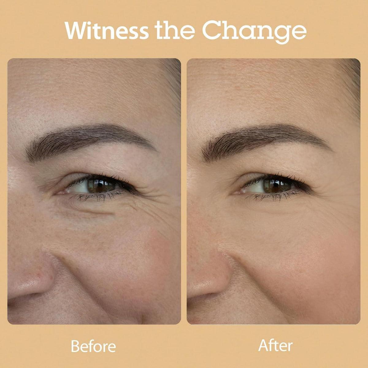 Blithe Vital Treatment 8 Nourishing Beans 150ml product detail image 6