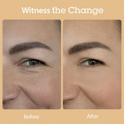Blithe Vital Treatment 8 Nourishing Beans 150ml product detail image 6