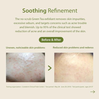 Blithe Patting Splash Mask Soothing &amp; Healing Green Tea 150ml product detail image 7