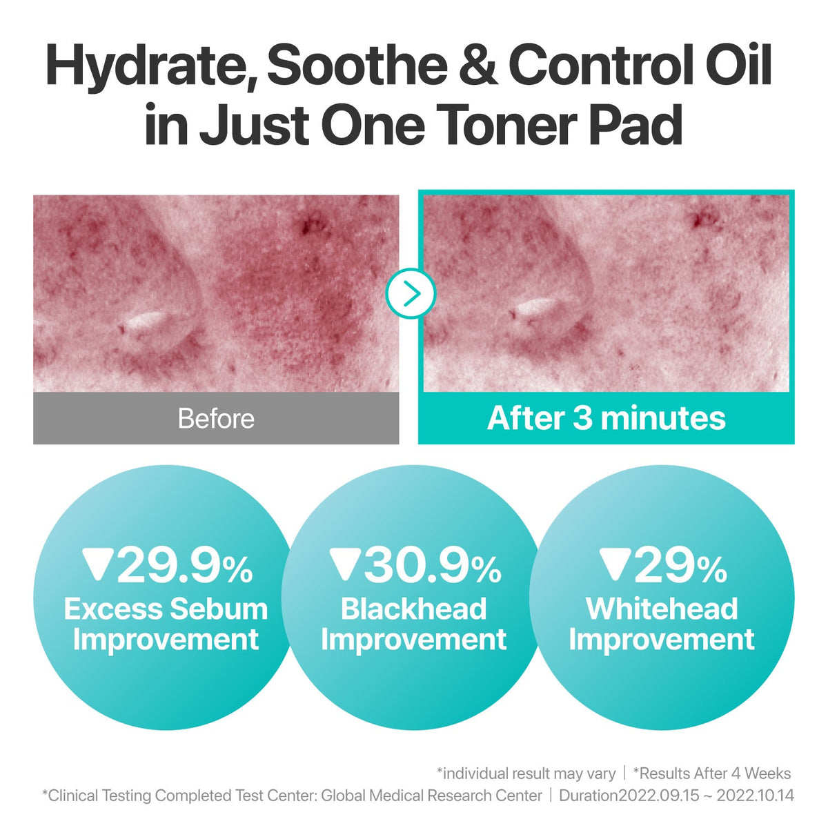 Numbuzin No. 1 Centella Re-Leaf Green Toner Pads 70 ct, 190ml — official product image 6