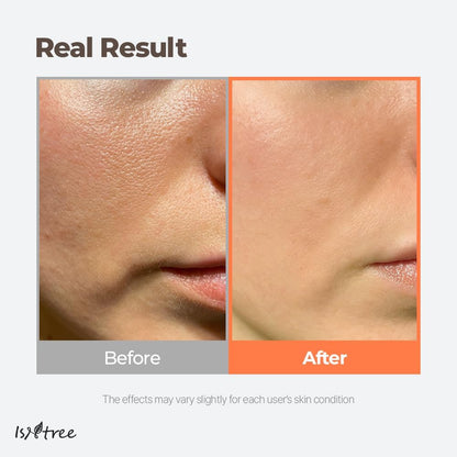 Isntree Green Tea Fresh Toner 200ml — Toners &amp; Astringents product image 58