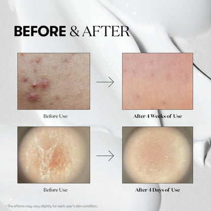 VT Cosmetics Reedle Shot 300 30ml - official product image 6