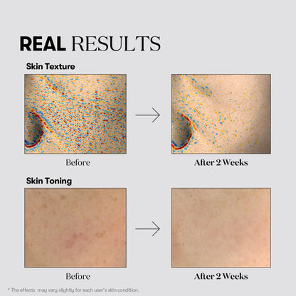 VT Cosmetics TX-Toning Daily Mask 30ea - official product image 6